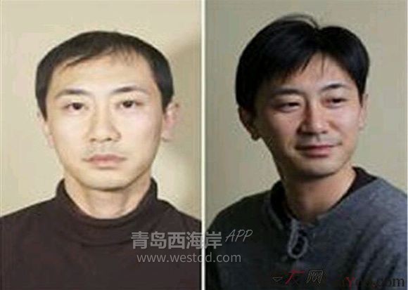白发，秃顶的福利来了。