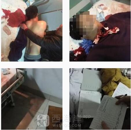 [生活杂谈]青岛西海岸新区第一人民医院重大医疗事故！