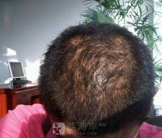 [同城交友]曾经，我是多么的不堪，但是今天我又是多么的优秀呢，你们自己看