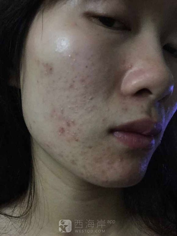 分享个人战豆经验