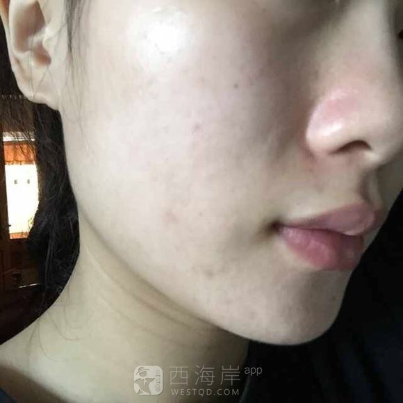 分享个人战豆经验