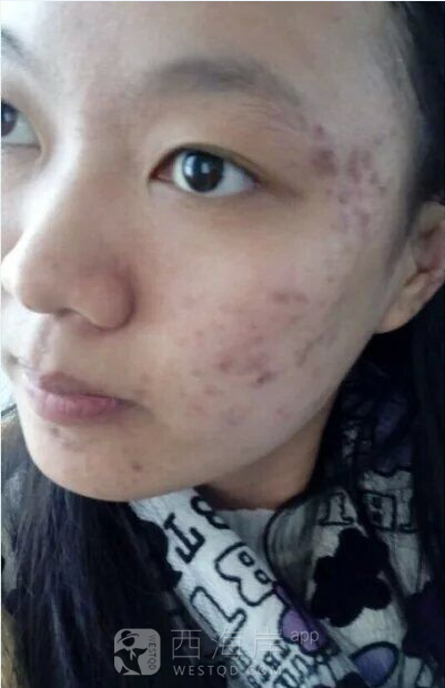 分享个人战豆经验