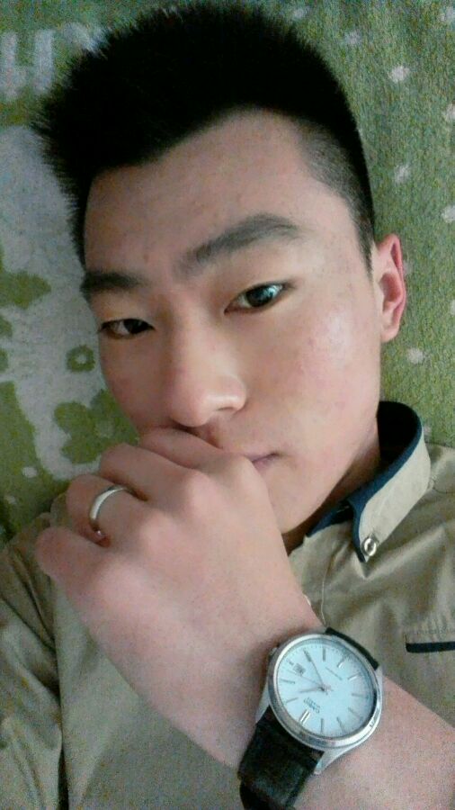 看脸的年代偏偏脸上有痘印！！
