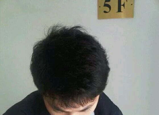 我不是难为我自己，而是置之死地而后生的，让大家看清我的生命