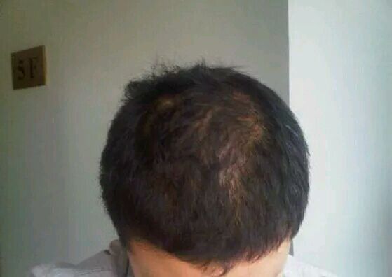 我不是难为我自己，而是置之死地而后生的，让大家看清我的生命