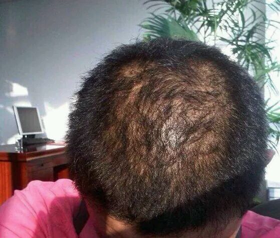 我不是难为我自己，而是置之死地而后生的，让大家看清我的生命