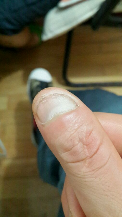 费了好大劲终于把一个指甲盖留长