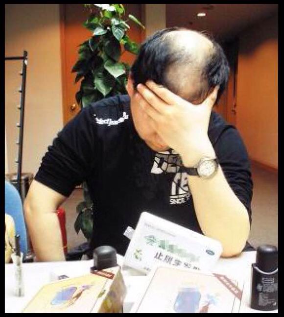 【每日一护发——脱发】谁偷走了你的头发?这些预防脱发的措施你一定