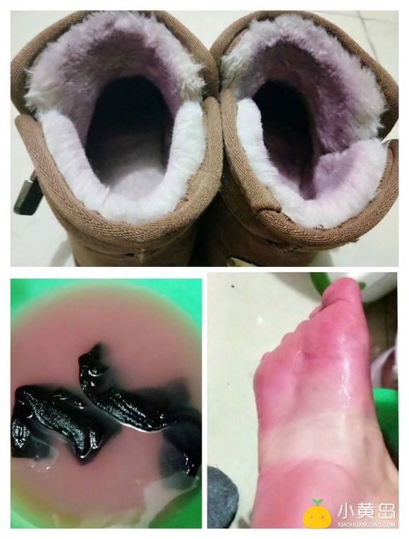 以后可不敢买大集上十块钱三双的袜子了