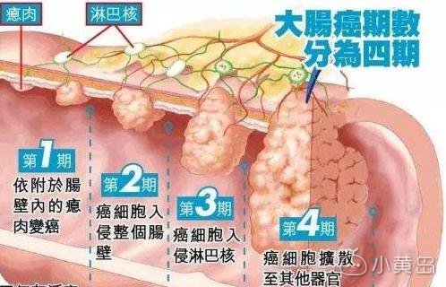 保险的疾病定义你真的了解吗？千万不要被别人忽悠！ ...