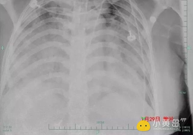 微信图片_20180402140828.jpg