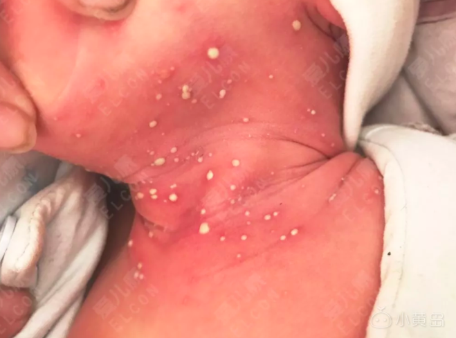 屏幕快照 2018-04-20 下午6.49.47.png