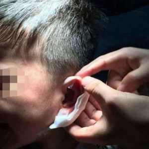 现“订书针门” 怎让孩远离坏老师伤害？