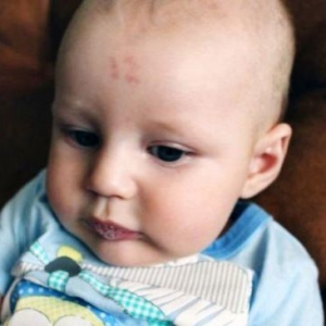 新生儿额头现数字胎记“12”