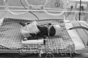 六个月早产儿体重仅800多克