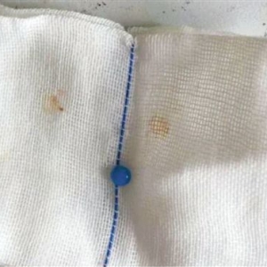 3岁宝宝耳朵疼了一夜原来里面藏着一颗玻璃珠