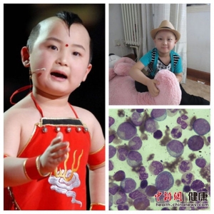 白血病成儿童肿瘤头号杀手 春晚福娃邓鸣贺因该病去世
