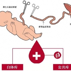 存脐带血真的有用吗？