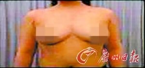 初产年龄超35岁 乳腺癌风险高两倍